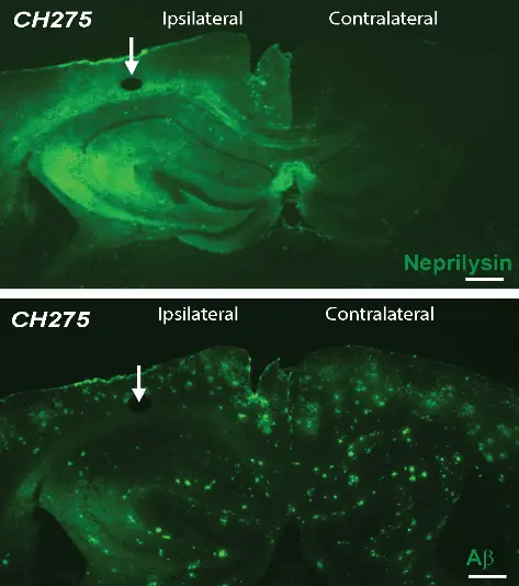 Bild från en hjärnavbildningskamera som jämför två hjärnor.