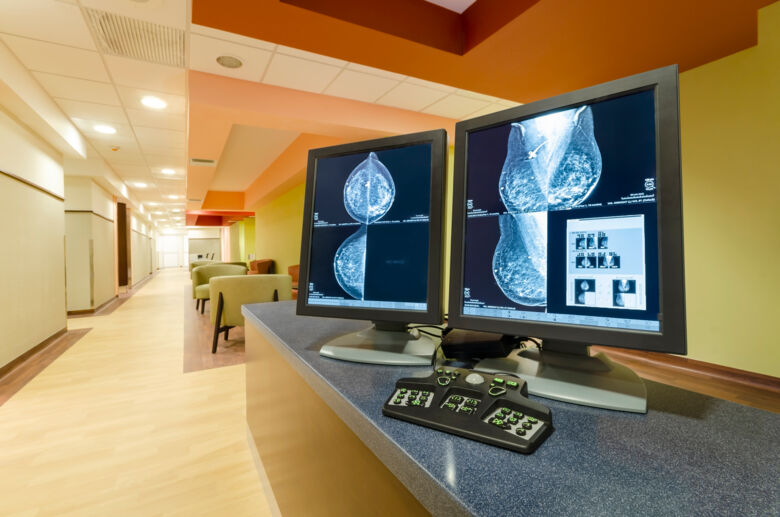 AI can find women at risk of developing breast cancer during a mammogram screening
