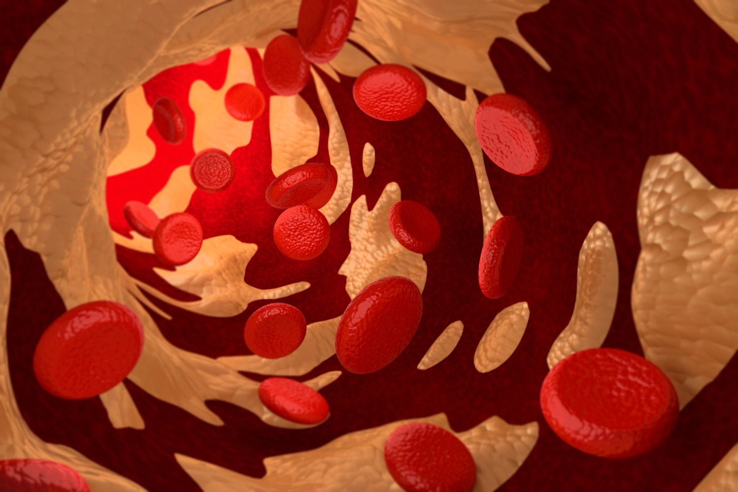 Le cellule immunitarie nel fegato mangiano il colesterolo “cattivo”.