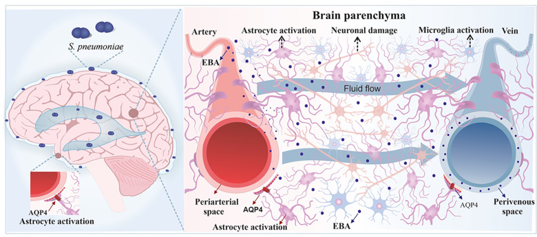 Glymfatiska systemet vid bakteriell hjärnhinneinflammation