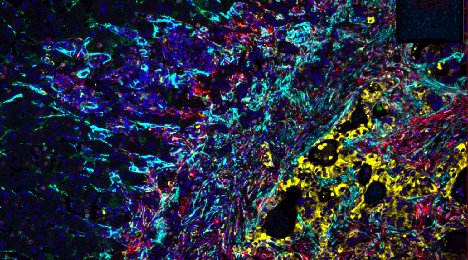 Seks holatdeniy zavyazim Qadimgi fohishalar emizadi