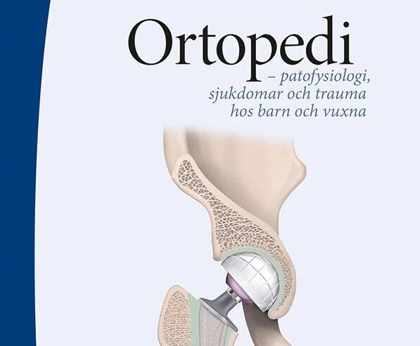 Ortopedi - patofysiologi, sjukdomar och trauma hos barn och vuxna
