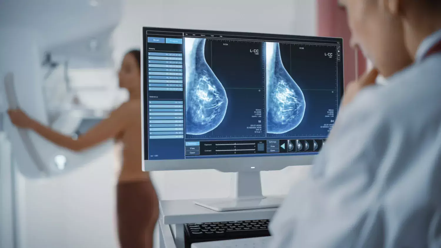 En kvinna genomgår mammografiundersökning och läkaren granskar bilderna på datorskärmen.