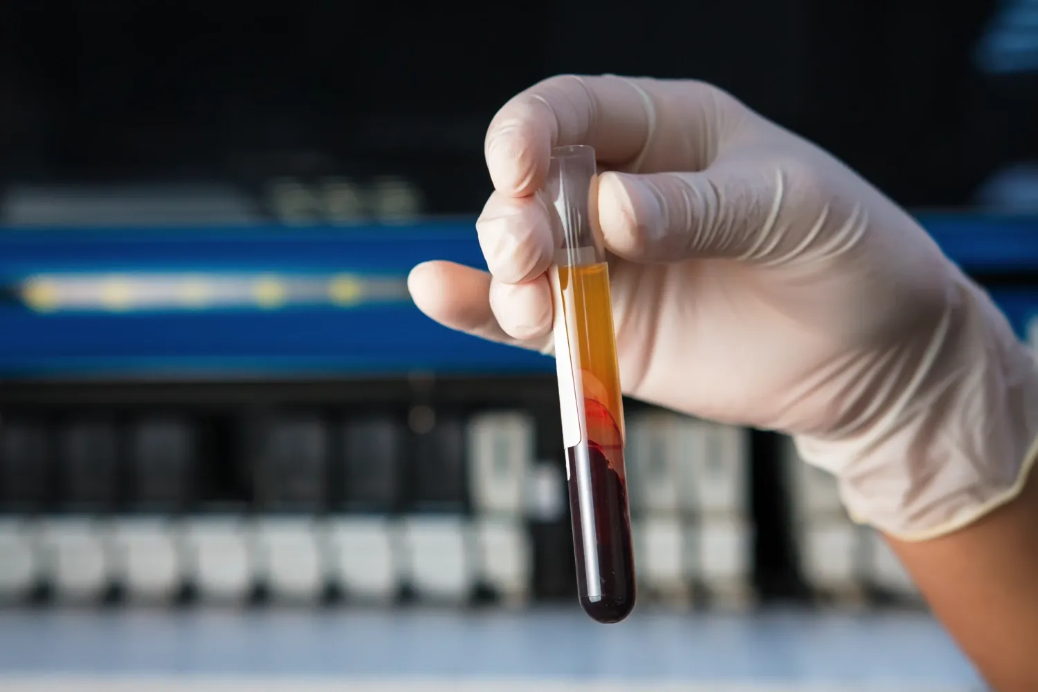 En hand i en plasthandske som håller ett blodrör på ett mikrobiologilaboratorium.