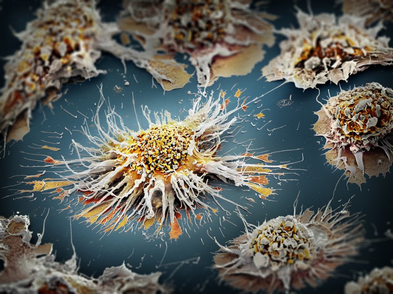 Dendritceller är antigenpresenterande celler som spelar en central roll i immunsystemet. Detta svepelektronmikrofotografi (SEM) är färglagt för hand och visar en stjärnliknande aktiverad dendritcell (i mitten) och hur den interag