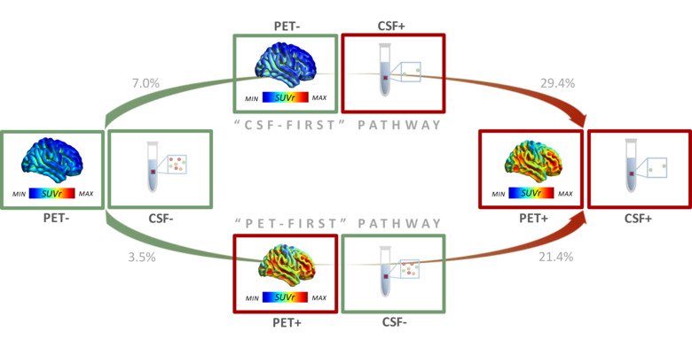 Grafik över CSV kontra PET för tidig upptäckt av amyloidansamlingar i hjärnan.