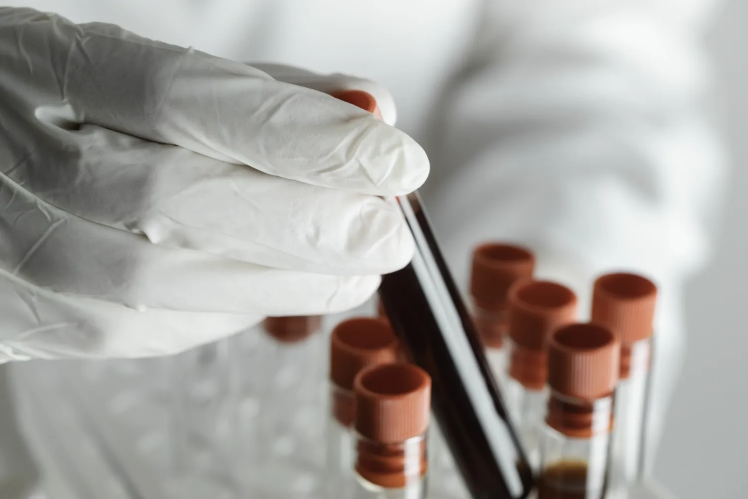 Provrör med blodprover.