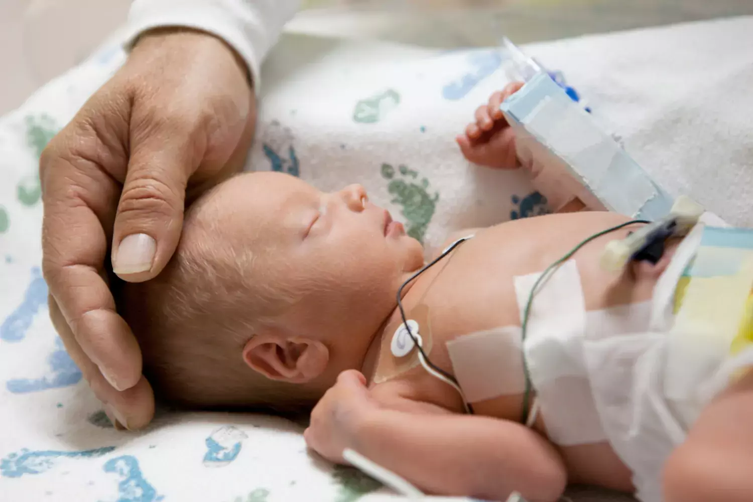 För tidigt född bebis. Getty Images.