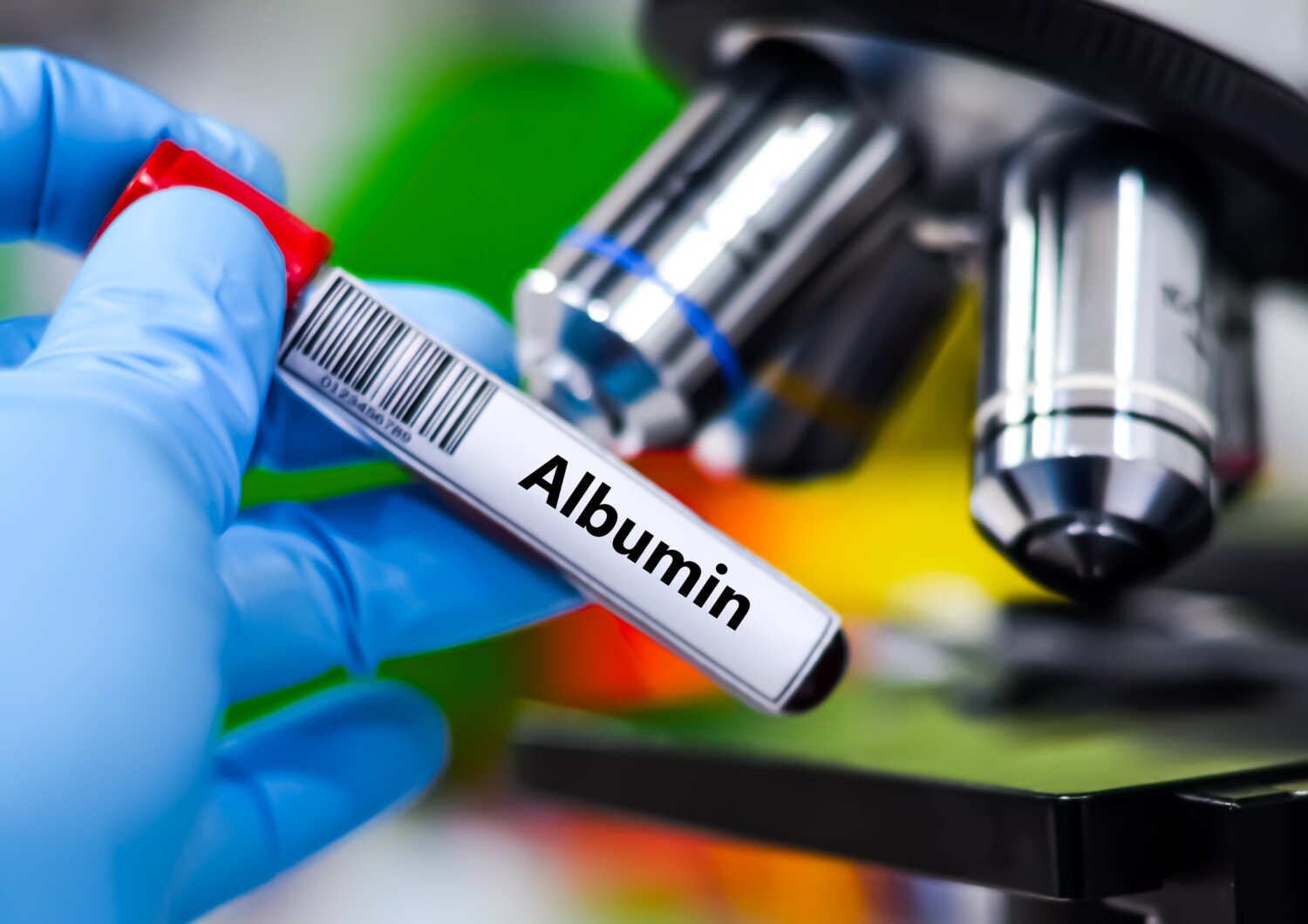 Albumin