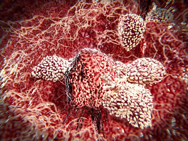 T-celler och NK-celler attackerar cancercell.