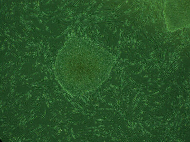 En grönfärgad mikroskopbild med ljusare skiftningar som visar cellerna.