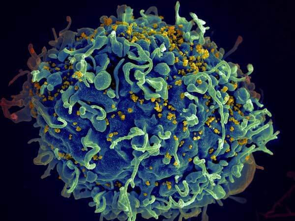 Bild av mänsklig T-cell som attackeras av hiv.