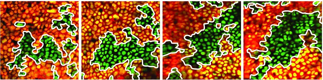 Mikroskopibild av friska celler (gröna) som motverkar muterad celltillväxt (röd) vid skada.