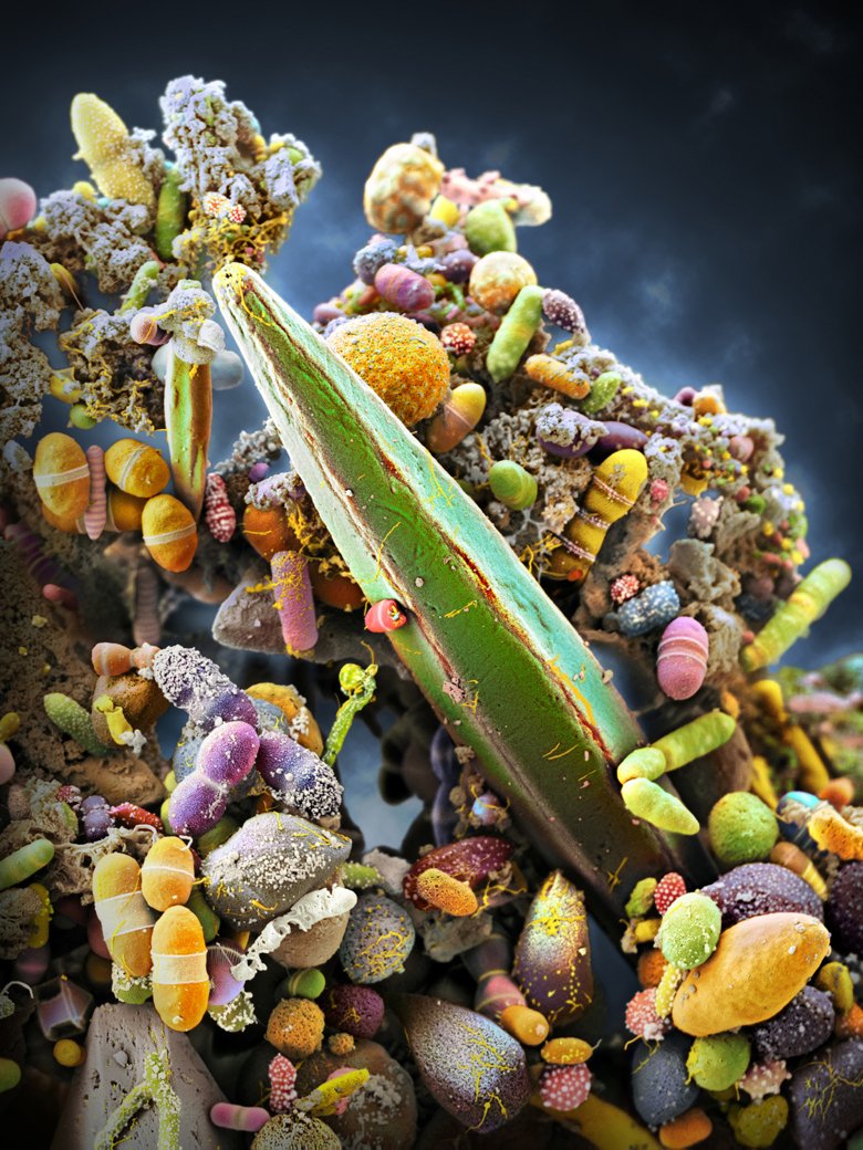 Konstnärlig färgläggning av bakteriefloran i en frisk mänsklig tarm, som innehåller miljarder tarmbakterier. Bilden har tagits med ett svepelektronmikroskop (SEM), varefter olika bakteriearter och strukturer har framhävts genom olika färger.