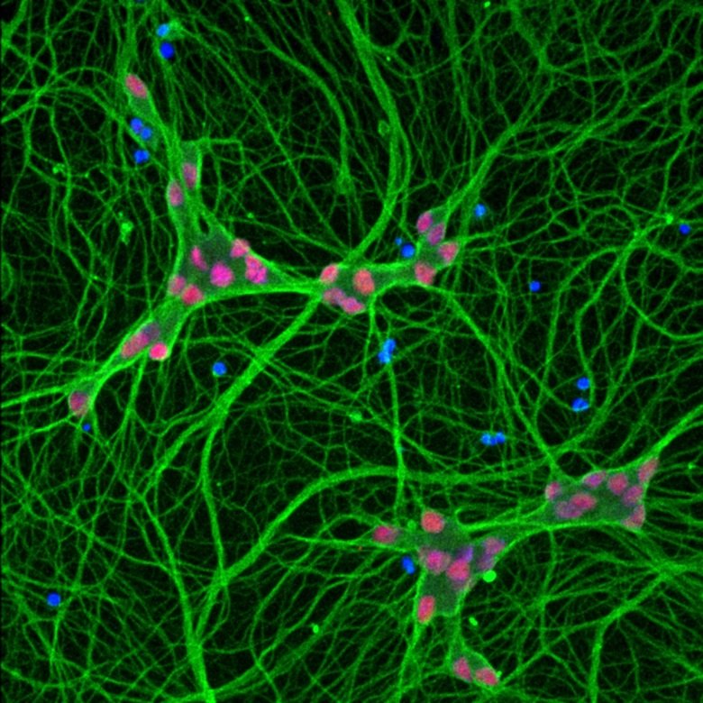 Human motor neurons formed from induced pluripotent stem cells.