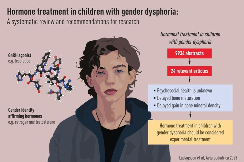 Illustration av en studie om könsdysfori hos unga