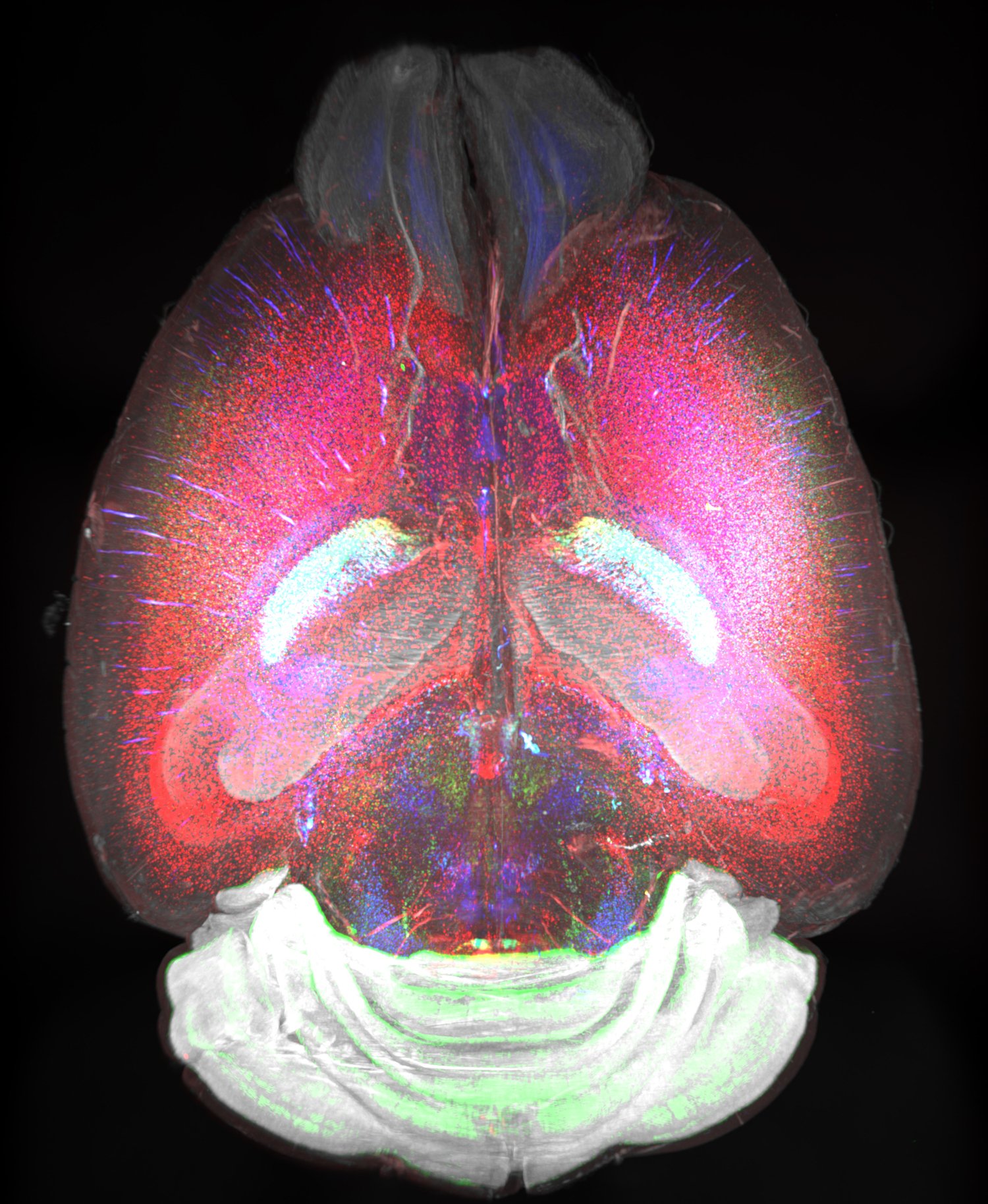 Tredimensionell visualisering av en intakt hjärna från en åtta veckor gammal mus, avbildad med TRISCO-metoden. RNA-molekylerna för somatostatin (Sst mRNA, röd), parvalbumin (Pvalb mRNA, grön) och glutamatdekarboxylas 1 (Gad1 mRNA, blå) har märkts in, och