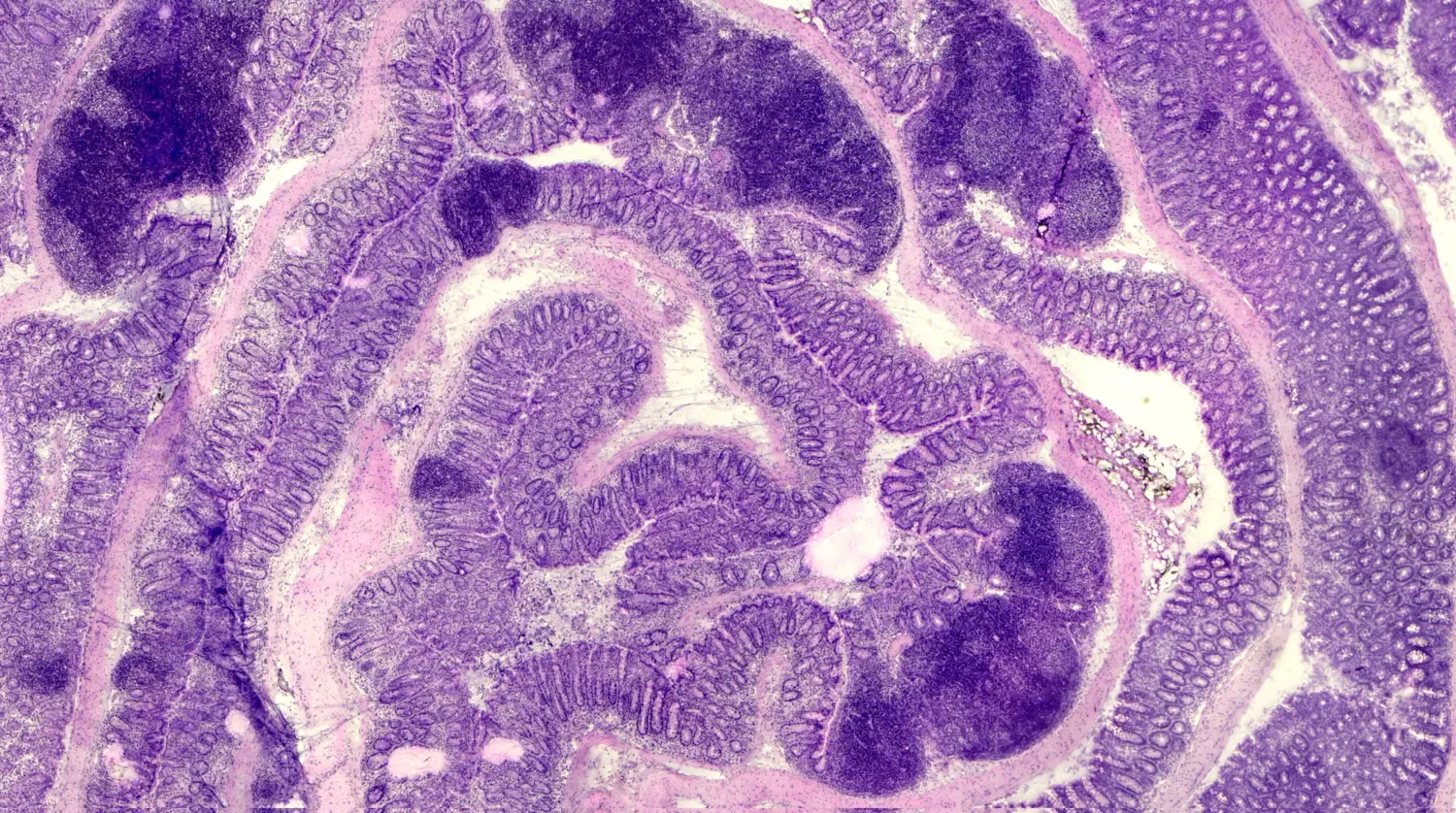 Histologisk bild från en inflammerad colon hos mus med olika färger.