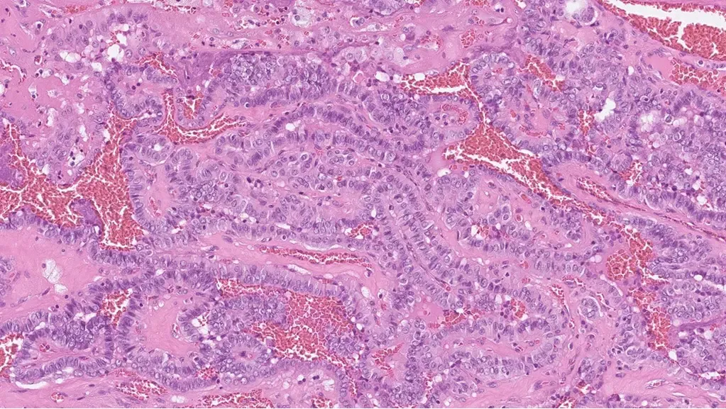Histologisk bild av celler i sköldkörteln.