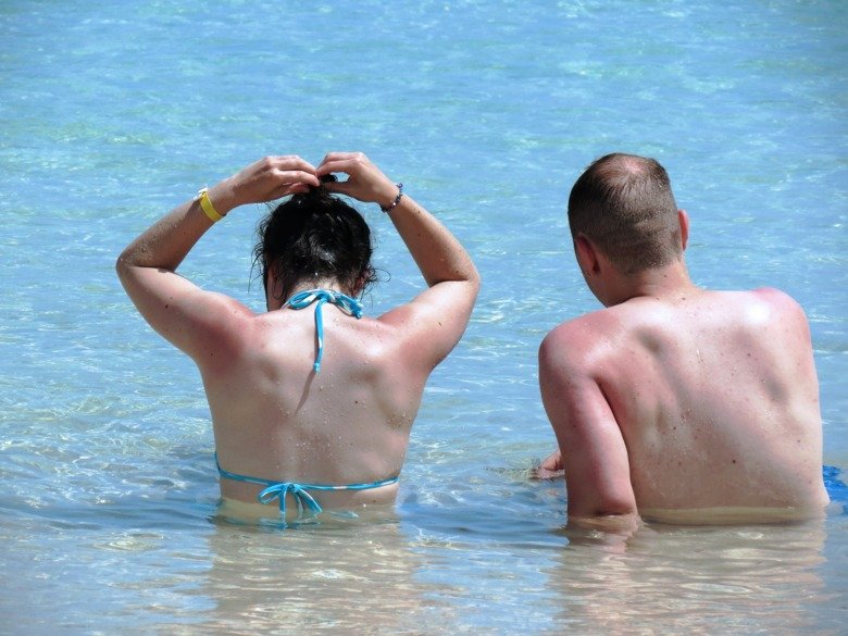 Man och kvinna bakifrån sittande i badkläder i solen. De har bränt sig på axlar och i nacken.