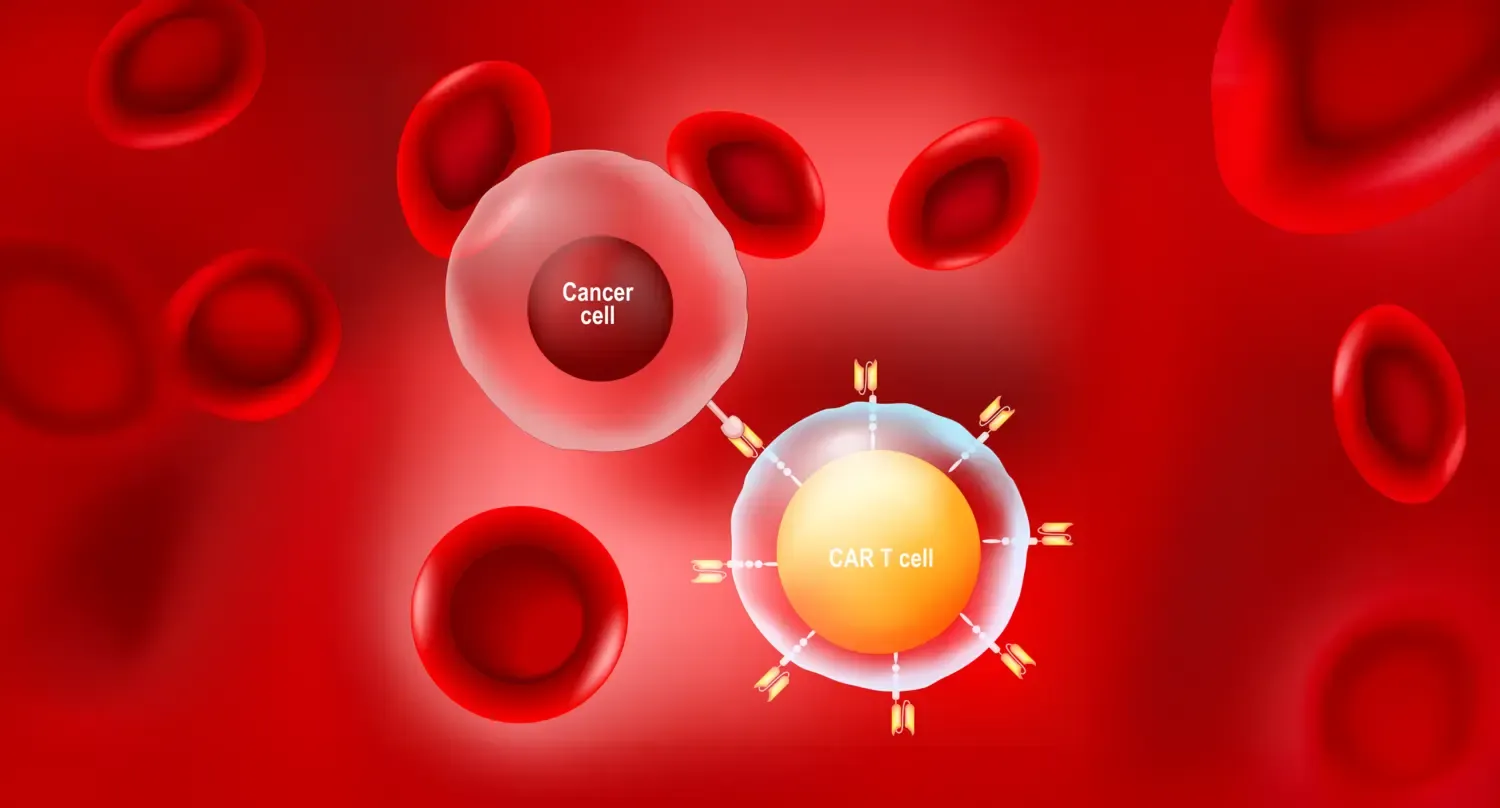 CAR T-cellsbehandling innebär att patientens egna T-celler modifieras genetiskt för att kunna angripa cancerceller. Bilden är en illustration av en cancercell och en modfierad T-cell.