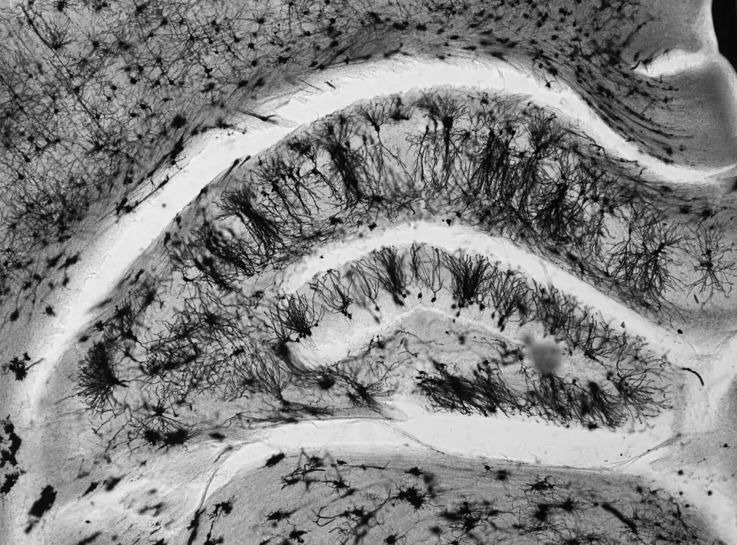 Golgifärgning av mus-hjärna, bild från Silvia Maioli-laboratoriet.