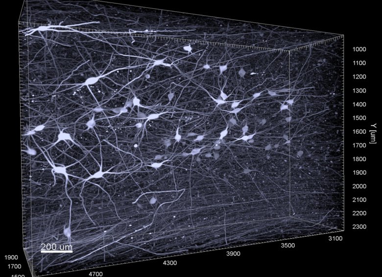 Noradrenergic neurons of the human locus coeruleus shell in three dimension.