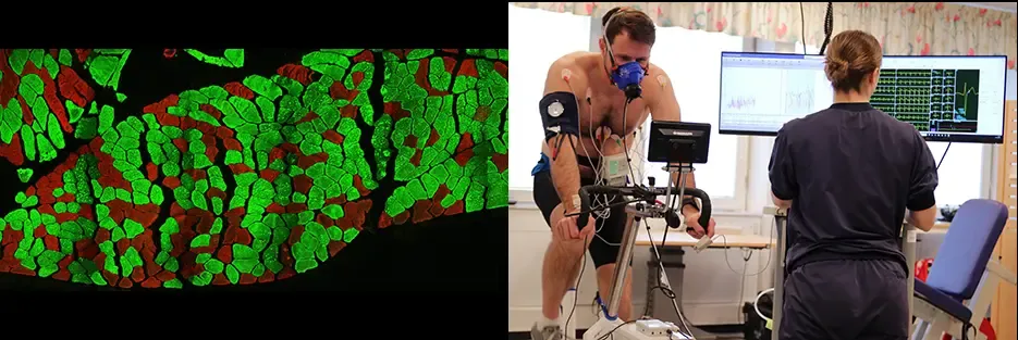 Två fotografier bredvid varandra varav en föreställer ett snitt av muskel som är färgad med immunohistokemi, som visar vilka muskler som är snabba och långsamma. Den andra bilden visar en testperson som gör arbetsprov på en testcykel.