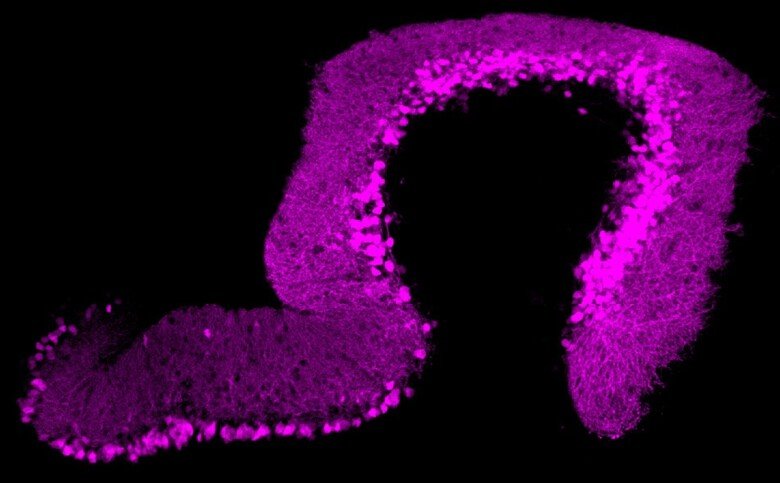purkinjeceller i lillhjärnan på vuxna zebrafiskar