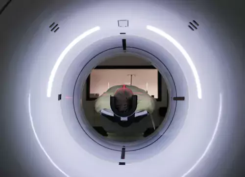A person in a CT scanner viewed from behind/above.