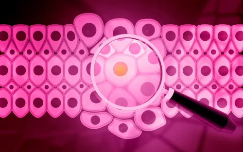 Pink‑toned illustration of cancer cells, partially seen through a magnifying glass.