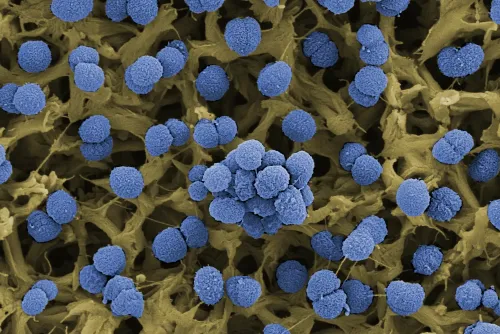 A coloured scanning electron microscope (SEM) picture of Neisseria meningitidis.