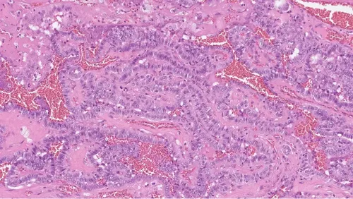 Histological image of cells in the thyroid.